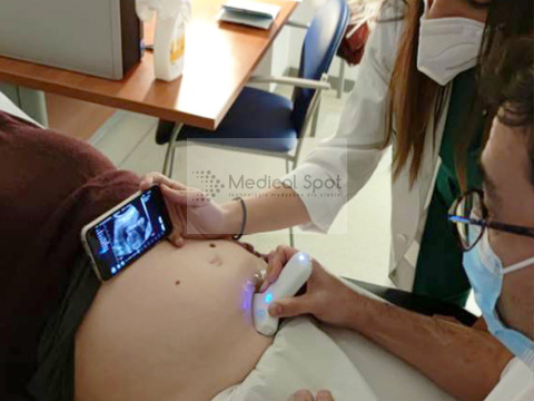 MyUSG C10RC. Bezprzewodowe USG ginekologia, położnictwo, badania ogólne. Dwie głowice w jednym urzadzeniu. MyUSG C10RC. Bezprzewodowe USG ginekologia, położnictwo, badania ogólne. Dwie głowice w jednym urzadzeniu.