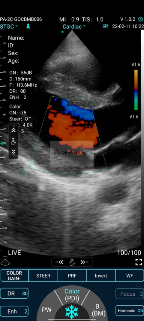 Przenośne USG C10TX Convex, Linia, Kardio, kolor Doppler gwarancja 3 lata Przenośne USG C10TX Convex, Linia, Kardio, kolor Doppler gwarancja 3 lata
