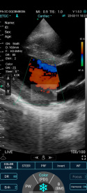 Mobilne USG 192 elementy. Ultrasonograf C10XS Convex, Linia, Kardio, kolor Doppler.