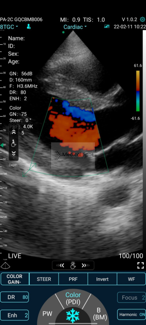 Mobilne USG 192 elementy. Ultrasonograf C10XS Convex, Linia, Kardio, kolor Doppler. Mobilne USG 192 elementy. Ultrasonograf C10XS Convex, Linia, Kardio, kolor Doppler.