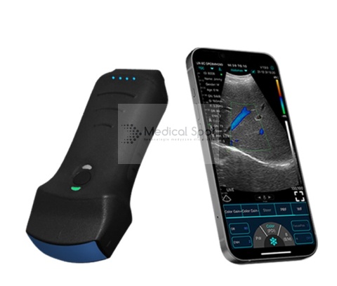 Ultrasonograf mobilny C10TX pro 192 elm. Ultrasonograf mobilny C10TX pro 192 elm.