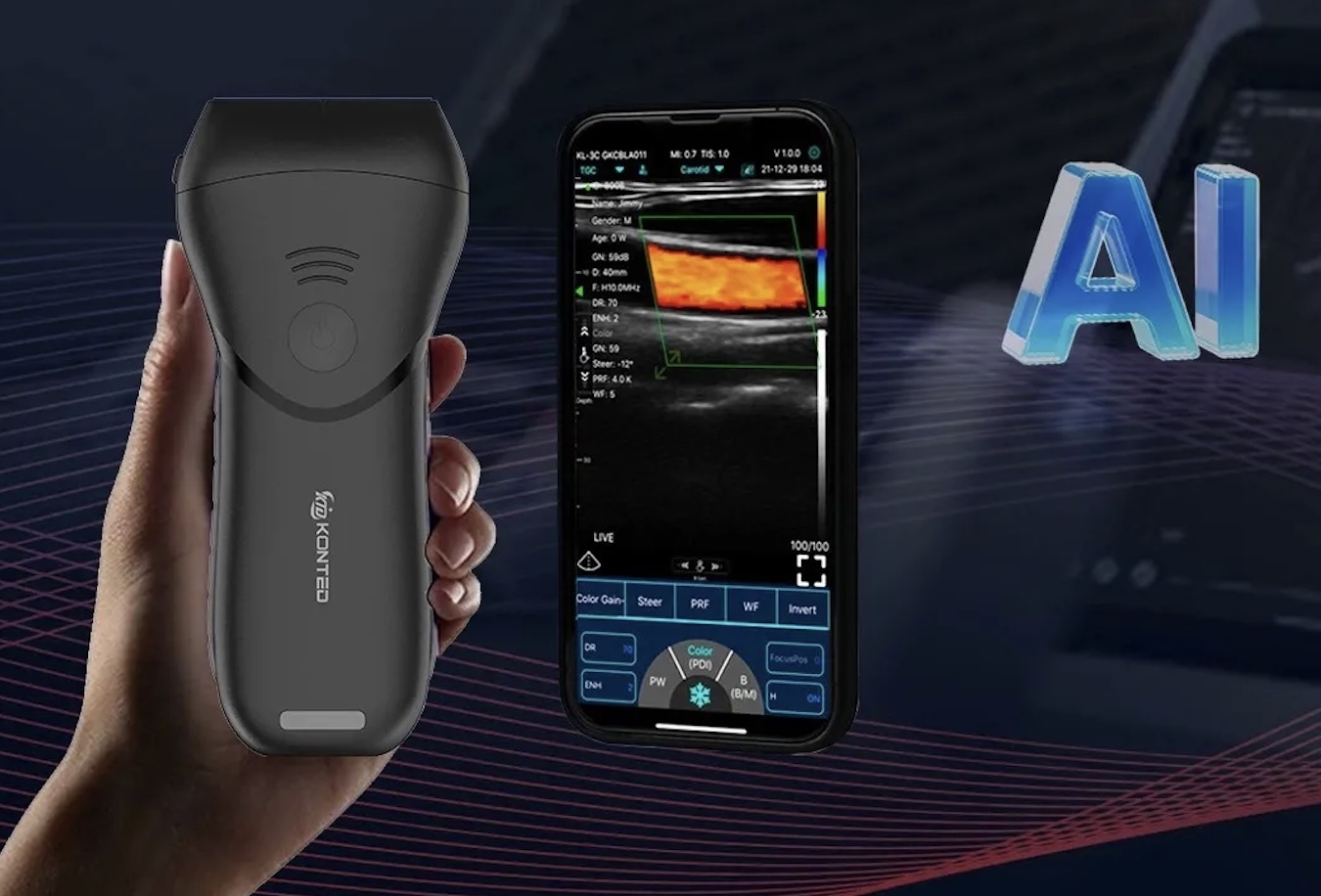 Ultrasonograf mobilny C10TX Pro z AI – inteligentne wsparcie diagnostyki USG w 7 obszarach medycyny