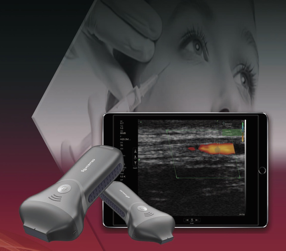 Ultrasonograf mobilny – jak wybrać przenośne USG do gabinetu, szpitala i wizyt domowych